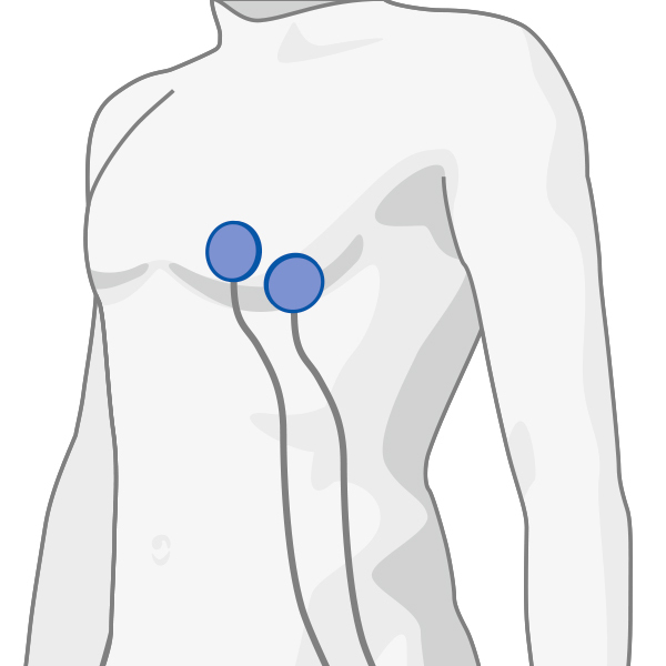Electrodes ECG